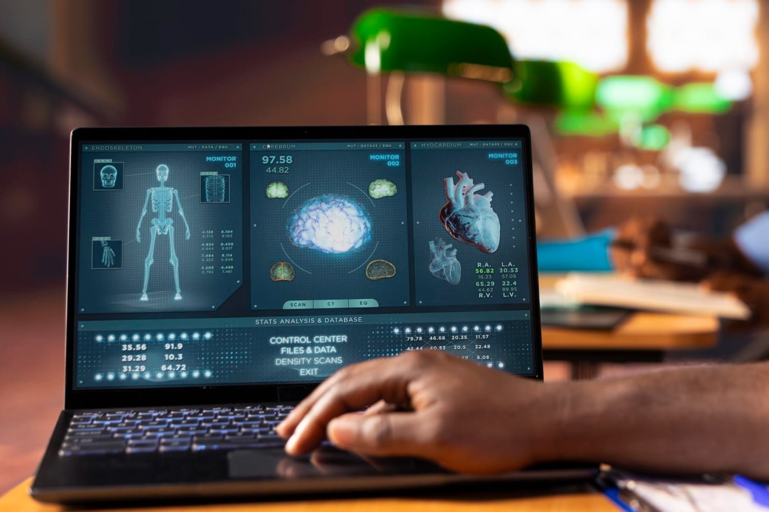 AI Is Transforming Personal Injury Cases